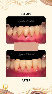 Lumia Dental Cheras 雪亮牙科诊所