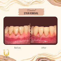 Lumia Dental Cheras 雪亮牙科诊所