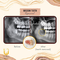 Lumia Dental Cheras 雪亮牙科诊所