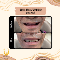 Lumia Dental Cheras 雪亮牙科诊所