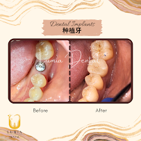 Lumia Dental Cheras 雪亮牙科诊所