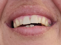 Özel Ihlamur Dent Ağız ve Diş Sağlığı Polikliniği