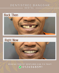 Dentistree Bangsar Dental Clinic