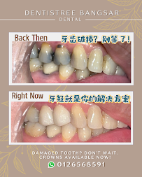 Dentistree Bangsar Dental Clinic