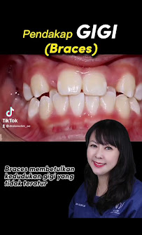 Klinik Pergigian E.L. Lim Dental Surgery Sri Petaling | Tooth Implant & Aesthetic Dentistry