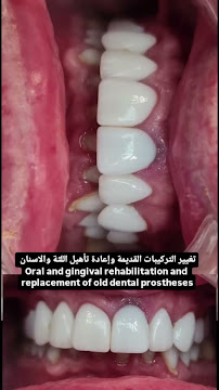 Dentist AHMET ALİVİ/Dental Clinic/طبيب أسنان عربي