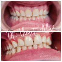 Dentist AHMET ALİVİ/Dental Clinic/طبيب أسنان عربي