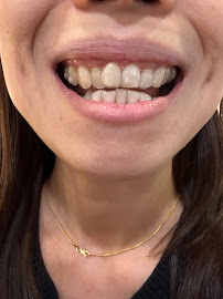 KL Dental Kiara (Top 1% Implant & Veneer Centre and Invisalign Diamond Provider)
