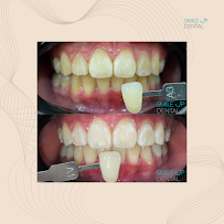 Klinik Pergigian Smile Up Dental (Mont Kiara)
