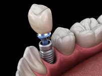 Cliniqa Dental World - Dental Treatment Clinic