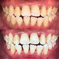 Klinik Pergigian Anne Dental, Setapak, Kuala Lumpur