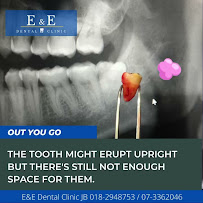 E&E Dental Clinic JB(DIAMOND INVISALIGN)