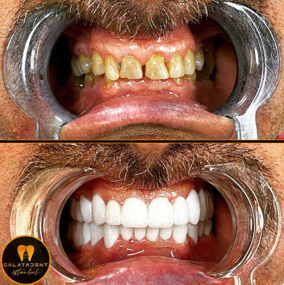 GalataDent Istanbul Diş Kliniği