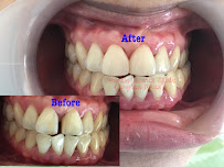 V-Smile Dental Clinic (Impian Emas)