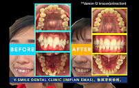 V-Smile Dental Clinic (Impian Emas)