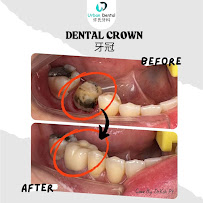 Urban Dental Clinic (Austin Crest) 许氏牙科诊所 Certified Invisalign Provider