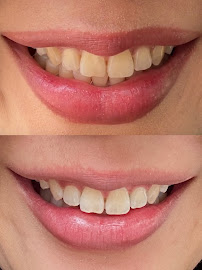 Ten Dental Clinic Johor Bahru