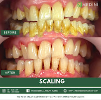 Medini Dental Austin - Aligner, Braces, Whitening Mount Austin
