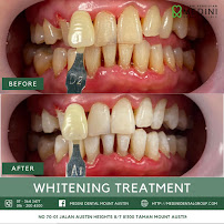 Medini Dental Austin - Aligner, Braces, Whitening Mount Austin