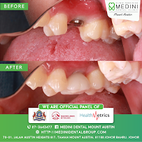 Medini Dental Austin - Aligner, Braces, Whitening Mount Austin