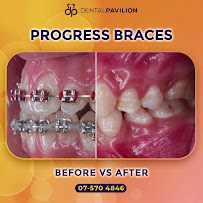 Klinik Pergigian Dental Pavilion Skudai Johor Bahru