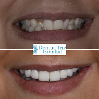 Dental Trip İstanbul