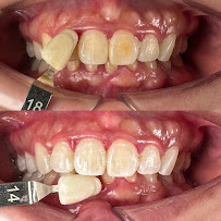 Le Dental Clinic | Painless Implant, Holistic Root Canal Treatment & Digital Veneers Centre 无痛种植牙，根管治疗 & 美牙牙贴片中心