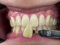 Le Dental Clinic | Painless Implant, Holistic Root Canal Treatment & Digital Veneers Centre 无痛种植牙，根管治疗 & 美牙牙贴片中心
