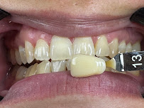 Le Dental Clinic | Painless Implant, Holistic Root Canal Treatment & Digital Veneers Centre 无痛种植牙，根管治疗 & 美牙牙贴片中心