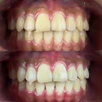 Le Dental Clinic | Painless Implant, Holistic Root Canal Treatment & Digital Veneers Centre 无痛种植牙，根管治疗 & 美牙牙贴片中心