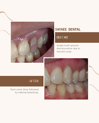 SHiNEE Dental JB Town