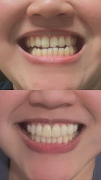 Klinik Pergigian Astana Dental (Neolux Dental)