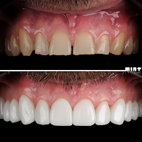 Clinica Mint - Clinica Dentária Lisboa