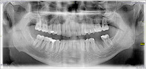 Clínica Dentária Vita Centro Lisboa