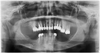 Clínica Dentária Vita Centro Lisboa