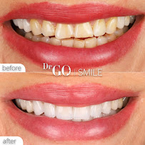 DRGO Smile Clinic - Istanbul Dental Aesthetic Clinic