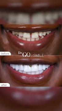 DRGO Smile Clinic - Istanbul Dental Aesthetic Clinic