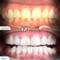 DRGO Smile Clinic - Istanbul Dental Aesthetic Clinic