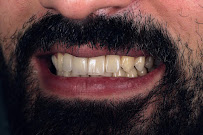 Dentist Ritz Carlton