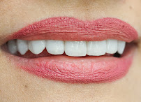 Dentist Ritz Carlton