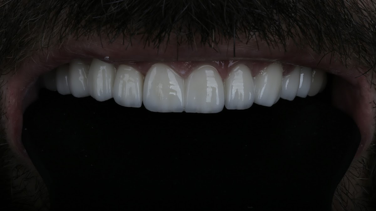 Taksim Dental Clinic