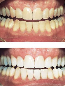 Taksim Dental Clinic
