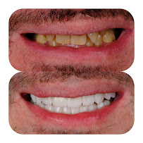 Taksim Dental Clinic
