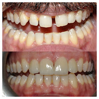 Taksim Dental Clinic