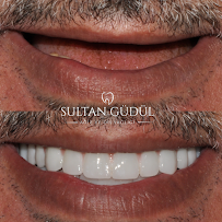 Taksim Dental Clinic