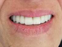 Taksim Dental Clinic