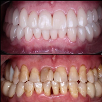 Taksim Dental Clinic