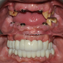 Taksim Dental Clinic