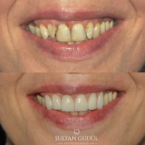 Taksim Dental Clinic