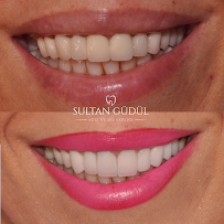 Taksim Dental Clinic
